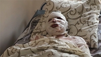 Стан потерпілих внаслідок ракетного удару ,14 липня по м Вінниця